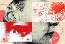 La gravità nascosta dell’herpes zoster: perché il “fuoco dell’inferno” è più di una semplice eruzione cutanea